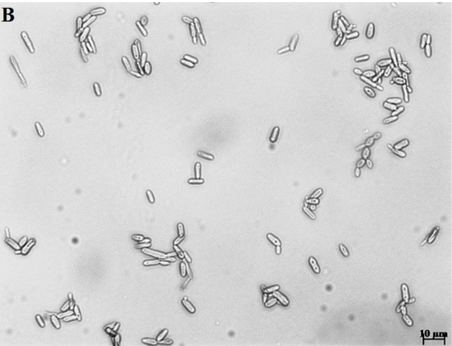 Microscopia de Sporothrix brasiliensis mostrando formas filamentosa e leveduriforme